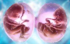 Редукция эмбриона при двойне