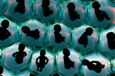 Редукция эмбрионов при ЭКО