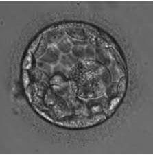 Удачная подсадка эмбрионов