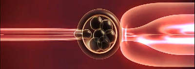 ПГД трехдневного эмбриона или бластоцисты