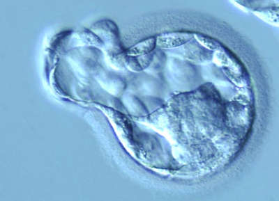 Как происходит прикрепление эмбриона к матке симптомы