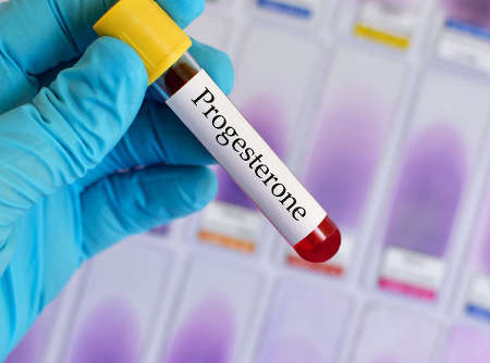Анализ крови на прогестерон при беременности