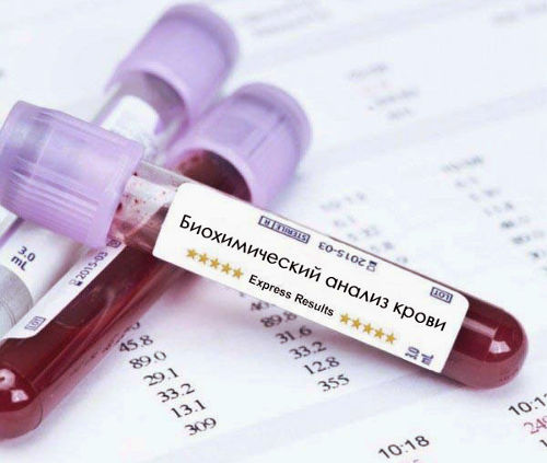 Биохимия крови нормы