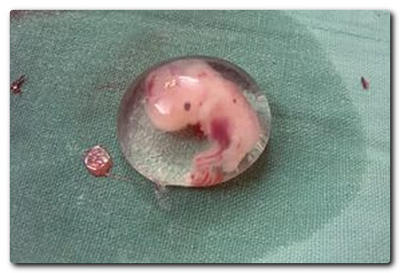 Что происходит с эмбрионом после подсадки в матку по дням после переноса