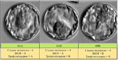 Классификация эмбрионов по качеству