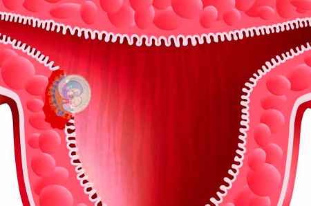 Имплантация эмбриона ощущения признаки выделения