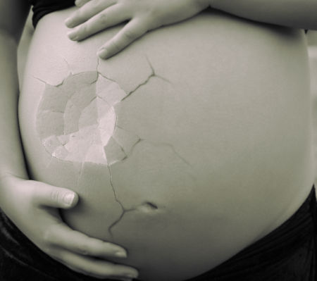 Последствия и риски поликистоза яичников при беременности