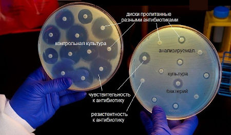 Посев мочи и определение чувствительности флоры к антибиотикам